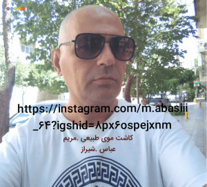 کاشت موی طبیعی.مریم عباسی.شیراز