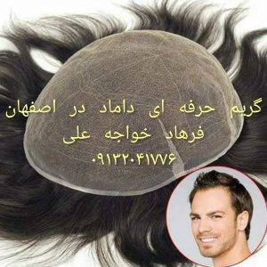 پروتز مو