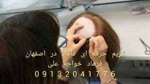 پروتز مو