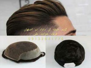 پروتز مو